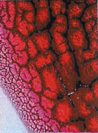 Geronnene Blut unter dem Mikroskop. Die schwarzen Rillen geben starke Verschmutzung an. Der Schicht an der Außenseite zeigt einen Vitamin C Mangel.